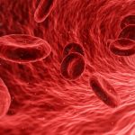 Anemia . que es se puede hacer deporte con anemia ferropenica