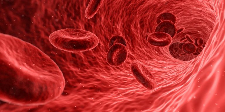 Anemia  . que es se puede hacer deporte con anemia ferropenica